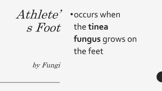 Athlete’
s Foot
by Fungi
•occurs when
the tinea
fungus grows on
the feet
 