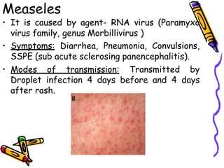 Measeles
• It is caused by agent- RNA virus (Paramyxo
virus family, genus Morbillivirus )
• Symptoms: Diarrhea, Pneumonia, Convulsions,
SSPE (sub acute sclerosing panencephalitis).
• Modes of transmission: Transmitted by
Droplet infection 4 days before and 4 days
after rash.
 