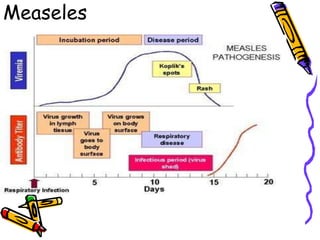 Measeles
 