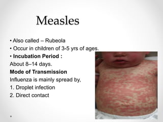 Measles
• Also called – Rubeola
• Occur in children of 3-5 yrs of ages.
• Incubation Period :
About 8–14 days.
Mode of Transmission
Influenza is mainly spread by,
1. Droplet infection
2. Direct contact
 