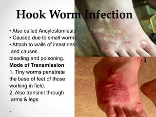 Hook Worm Infection
• Also called Ancylostomiasis
• Caused due to small worms
• Attach to walls of intestines
and causes
bleeding and poisoning.
Mode of Transmission
1. Tiny worms penetrate
the base of feet of those
working in field.
2. Also transmit through
arms & legs.
 