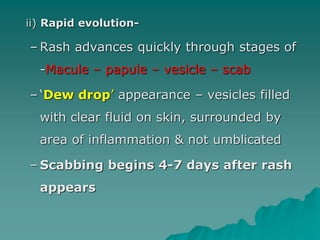 ii) Rapid evolution-
– Rash advances quickly through stages of
-Macule – papule – vesicle – scab
– ‘Dew drop’ appearance – vesicles filled
with clear fluid on skin, surrounded by
area of inflammation & not umblicated
– Scabbing begins 4-7 days after rash
appears
 