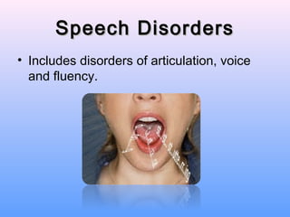 Speech Disorders
• Includes disorders of articulation, voice
  and fluency.
 