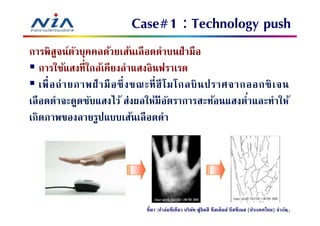 Case#1 : Technology push
การพิสจน์ตวบุคคลด้วยเส้นเลื อดดําบนฝ่ ามือ
         ู ั
    การใช้แสงทีใกล้เคียงลําแสงอินฟราเรด
    เพื อถ่ า ยภาพฝ่ ามื อ ซึ งขณะที ฮี โ มโกลบิ น ปราศจากออกซิ เ จน
เลื อดดําจะดูดซับแสงไว้ ส่งผลให้มีอตราการสะท้อนแสงตําและทําให้
                                          ั
เกิดภาพของลายรูปแบบเส้นเลื อดดํา




                              ทีมา :ปาล์มซีเคียว บริษท ฟูจิตสึ ซีสเต็มส์ บีสซีเนส (ประเทศไทย) จํากัด
                                                     ั                                             77
 