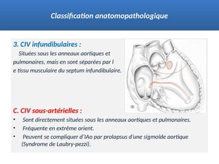 3. CIV infundibulaires :
Situées sous les anneaux aortiques et
pulmonaires, mais en sont séparées par l
e tissu musculaire du septum infundibulaire.
C. CIV sous-artérielles :
• Sont directement situées sous les anneaux aortiques et pulmonaires.
• Fréquente en extrême orient.
• Peuvent se compliquer d’IAo par prolapsus d’une sigmoïde aortique
(Syndrome de Laubry-pezzi).
Classification anatomopathologique
 