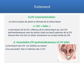 b.CIV conoventriculaire:
La mise en place du patch se déroule de la même façon.
c. CIV « inlet »:
La fermeture de la CIV s effectue de la même façon qu' une CIV
périmembraneuse mais les points situés au bord supérieur de la CIV
doivent être très fins et situés strictement sur la face droite du SIV.
d. Association CIV perimembraneuse et CIV inlet:
La fermeture des CIV est réalisée au moyen
d’un seul patch fixé à l extérieur des 2 CIV.
Traitement
 