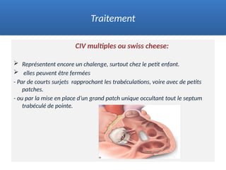 CIV multiples ou swiss cheese:
 Représentent encore un chalenge, surtout chez le petit enfant.
 elles peuvent être fermées
- Par de courts surjets rapprochant les trabéculations, voire avec de petits
patches.
- ou par la mise en place d’un grand patch unique occultant tout le septum
trabéculé de pointe.
.
Traitement
 