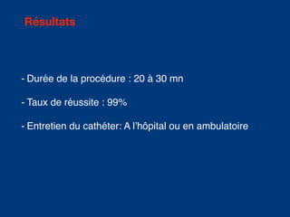 - Durée de la procédure : 20 à 30 mn
- Taux de réussite : 99%
- Entretien du cathéter: A l’hôpital ou en ambulatoire
Résultats
 