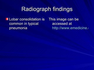 Radiograph findings Lobar consolidation is common in typical pneumonia This image can be accessed at  http://www.emedicine.com/med/images/187614_2228CONSOLID.JPG 