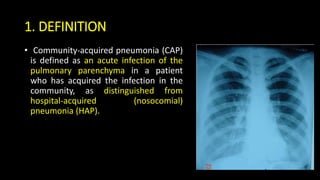 1. DEFINITION
• Community-acquired pneumonia (CAP)
is defined as an acute infection of the
pulmonary parenchyma in a patient
who has acquired the infection in the
community, as distinguished from
hospital-acquired (nosocomial)
pneumonia (HAP).
 