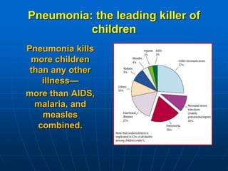 Community acquired pneumonia (cap) in 