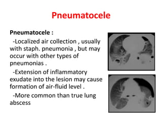 Pneumatocele
Pneumatocele :
-Localized air collection , usually
with staph. pneumonia , but may
occur with other types of
pneumonias .
-Extension of inflammatory
exudate into the lesion may cause
formation of air-fluid level .
-More common than true lung
abscess
 