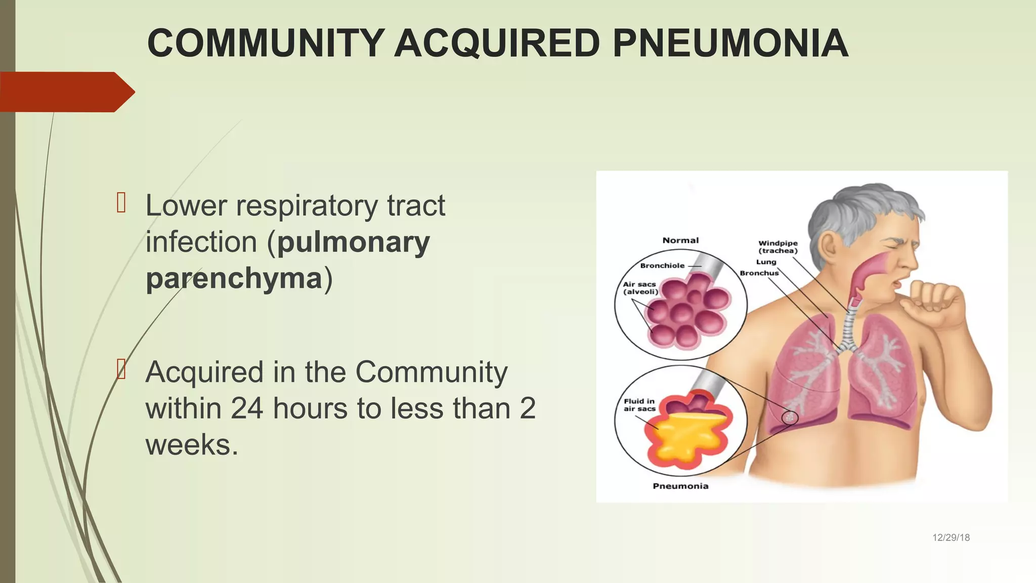 Community acquired pneumonia cpg 2016 | PPT