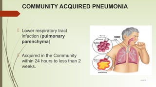 Community acquired pneumonia cpg 2016