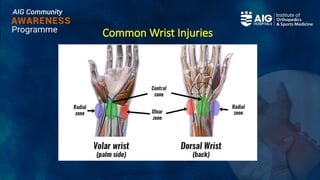 Common Wrist Injuries
 