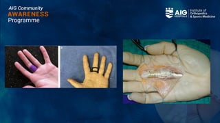 Community Awareness programme for athelets.pptx