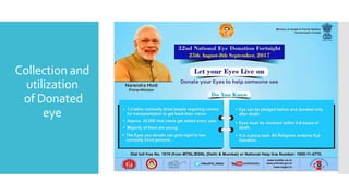 Collection and
utilization
of Donated
eye
 