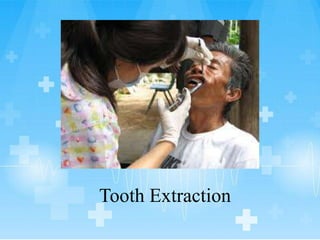 Tooth Extraction
 