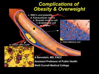 Complications of
Obesity & Overweight
A Bornstein, MD, FACCA Bornstein, MD, FACC
Assistant Professor of Public HealthAssistant Professor of Public Health
Weill Cornell Medical CollegeWeill Cornell Medical College
 