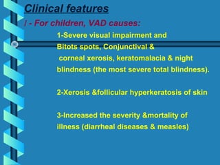 Clinical features
I - For children, VAD causes:
1-Severe visual impairment and
Bitots spots, Conjunctival &
corneal xerosis, keratomalacia & night
blindness (the most severe total blindness).
2-Xerosis &follicular hyperkeratosis of skin
3-Increased the severity &mortality of
illness (diarrheal diseases & measles)
 