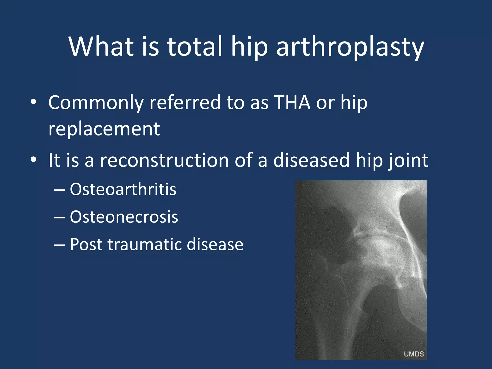 What is total hip arthroplasty
• Commonly referred to as THA or hip
replacement
• It is a reconstruction of a diseased hip joint
– Osteoarthritis
– Osteonecrosis
– Post traumatic disease
 