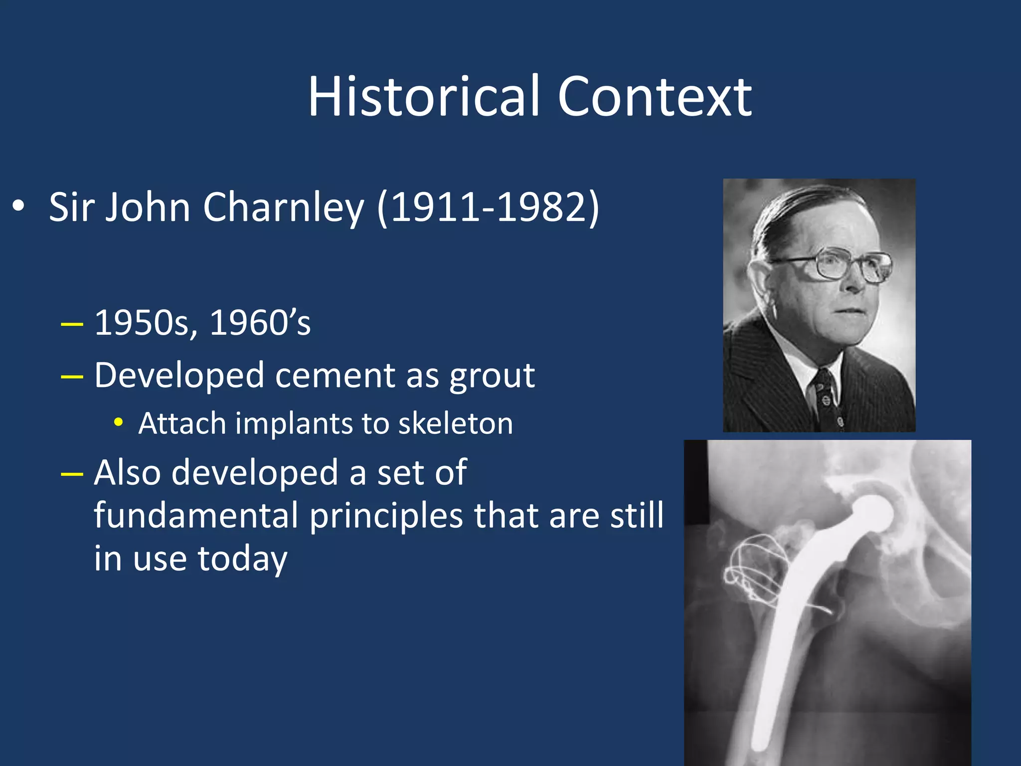 Historical Context
• Sir John Charnley (1911-1982)
– 1950s, 1960’s
– Developed cement as grout
• Attach implants to skeleton
– Also developed a set of
fundamental principles that are still
in use today
 