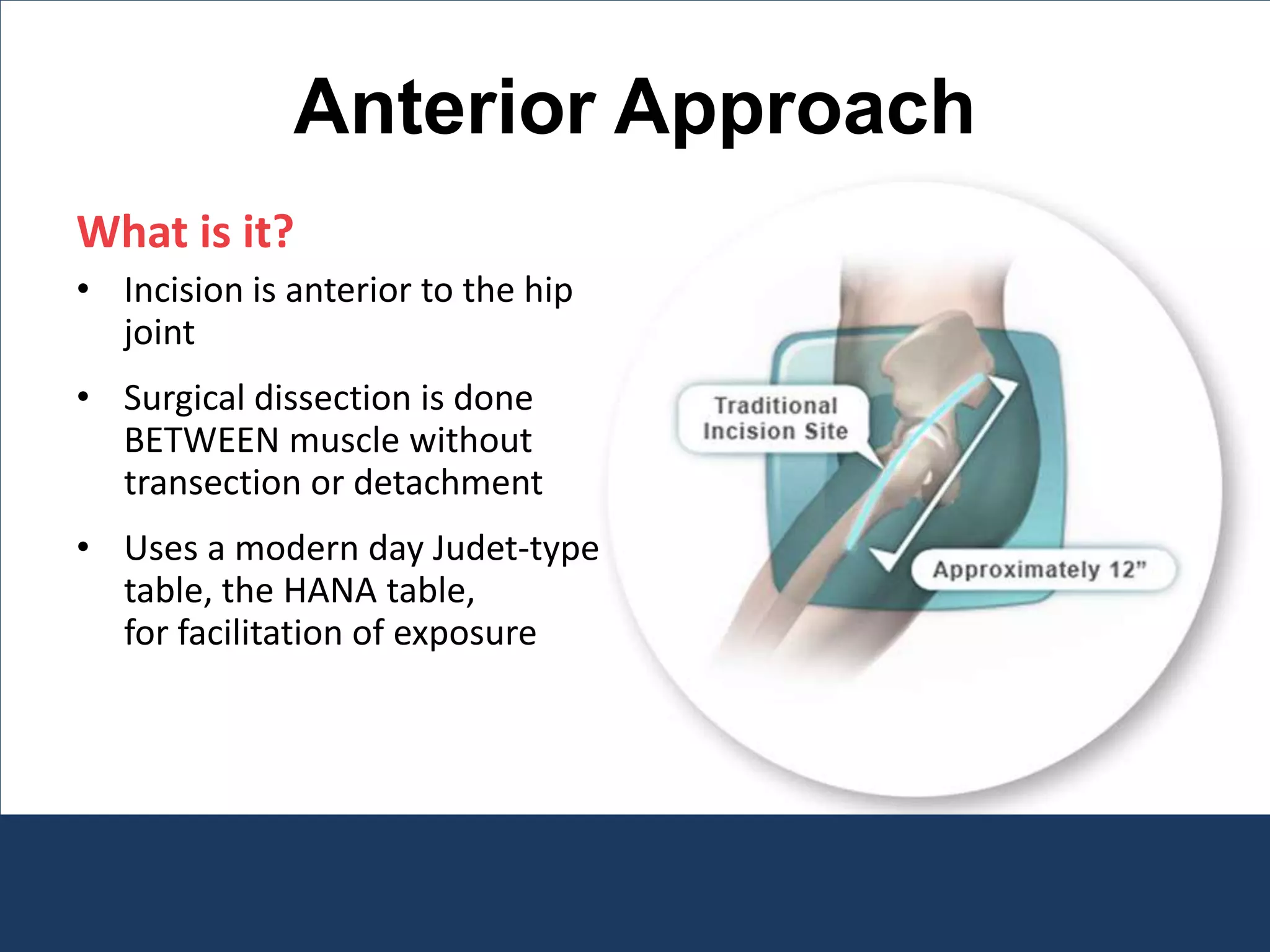 Anterior Approach
What is it?
• Incision is anterior to the hip
joint
• Surgical dissection is done
BETWEEN muscle without
transection or detachment
• Uses a modern day Judet-type
table, the HANA table,
for facilitation of exposure
 