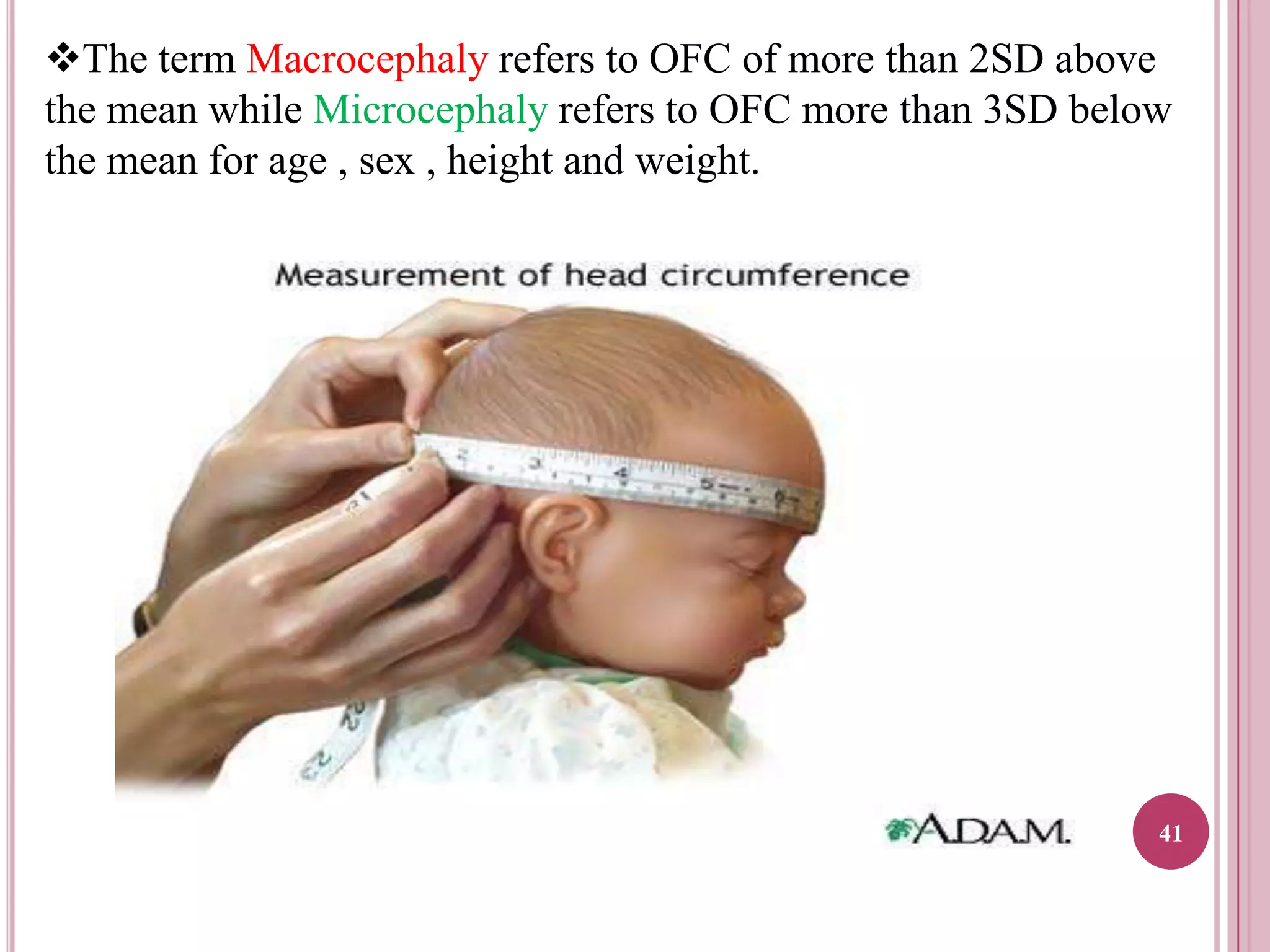 The term Macrocephaly refers to OFC of more than 2SD above
the mean while Microcephaly refers to OFC more than 3SD below
the mean for age , sex , height and weight.

41

 