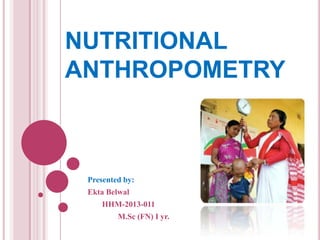 NUTRITIONAL
ANTHROPOMETRY

Presented by:
Ekta Belwal
HHM-2013-011
M.Sc (FN) I yr.

 