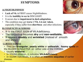 A) NIGHT BLINDNESS
• Lack of Vit. A FIRST causes Nightblindness.
• It is the inability to see in DIM LIGHT.
• It occurs due to impairment in dark adaptation.
• The condition may get worse if Vit. A is not taken,
especially if they suffer from diarrhoea and other infections.
B) CONJUNCTIVALXEROSIS
• It is the FIRST SIGN of Vit.Adeficiency.
• The conjuctiva becomes dry and non-wettable.
• It appears muddy and wrinkled (instead of smooth
and shiny)
C) BITOT’S SPOTS
• They are triangular, pearly white or yellowish, foamy spots on
the BULBAR CONJUCTIVA on either side of the CORNEA.
• Usually bilateral.
• In YOUNG children, it indicates Vit.Adeficiency.
• In OLDER individuals, it is often an inactive sequelae of earlier
disease.
SYMPTOMS
 