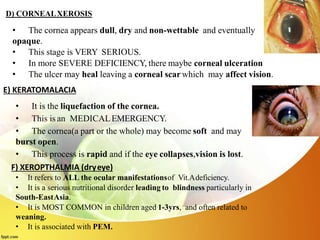 D) CORNEALXEROSIS
• The cornea appears dull, dry and non-wettable and eventually
opaque.
• This stage is VERY SERIOUS.
• In more SEVERE DEFICIENCY, there maybe corneal ulceration
• The ulcer may heal leaving a corneal scar which may affect vision.
• It is the liquefaction of the cornea.
• This is an MEDICALEMERGENCY.
• The cornea(a part or the whole) may become soft and may
burst open.
• This process is rapid and if the eye collapses,vision is lost.
E) KERATOMALACIA
F) XEROPTHALMIA (dryeye)
• It refers to ALL the ocular manifestationsof Vit.Adeficiency.
• It is a serious nutritional disorder leading to blindness particularly in
South-EastAsia.
• It is MOST COMMON in children aged 1-3yrs, and often related to
weaning.
• It is associated with PEM.
 