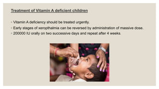 Treatment of Vitamin A deficient children
◦ Vitamin A deficiency should be treated urgently.
◦ Early stages of xeropthalmia can be reversed by administration of massive dose.
◦ 200000 IU orally on two successive days and repeat after 4 weeks.
 