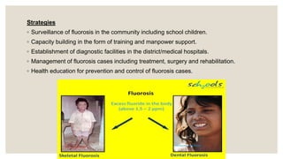 Strategies
◦ Surveillance of fluorosis in the community including school children.
◦ Capacity building in the form of training and manpower support.
◦ Establishment of diagnostic facilities in the district/medical hospitals.
◦ Management of fluorosis cases including treatment, surgery and rehabilitation.
◦ Health education for prevention and control of fluorosis cases.
 