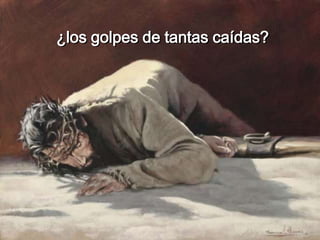 ¿los golpes de tantas caídas?
 