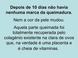 Como tratar queimaduras!