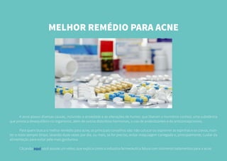 MELHOR REMÉDIO PARA ACNE
	 A acne possui diversas causas, incluindo a ansiedade e as alterações de humor, que liberam o hormônio cortisol, uma substância
que provoca desequilíbrio no organismo, além de outros distúrbios hormonais, o uso de anabolizantes e de anticoncepcionais.
	 Para quem busca o melhor remédio para acne, os principais conselhos são: não cutucar ou espremer as espinhas e os cravos, man-
ter o rosto sempre limpo, lavando duas vezes por dia, ou mais, se for preciso, evitar maquiagem carregada e, principalmente, cuidar da
alimentação para evitar pele mais gordurosa.
	 Clicando aqui você assiste um vídeo, que explica como a indústria farmaceutica fatura com inúmeros tratamentos para a acne.
 