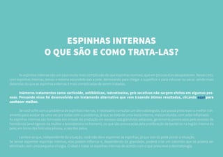 ESPINHAS INTERNAS
O QUE SÃO E COMO TRATA-LAS?
	 As espinhas internas são um caso muito mais complicado do que espinhas normais, que em poucos dias desaparecem. Nesse caso,
com espinhas internas, temos a mesma escondida sob a pele, demorando para chegar à superfície e para estourar ou secar, sendo mais
doloridas do que as espinhas externas e mais complicadas de serem tratadas.
	 Inúmeros tratamentos como corticoide, antibióticos, isotretinoína, geis secativos não surgem efeitos em algumas pes-
soas. Pensando nisso foi desenvolvido um tratamento alternativo que vem trazendo ótimos resultados, clicando aqui para
conhecer melhor.
	 Se você sofre com o problema de espinhas internas, é necessário consultar um dermatologista, que possa prescrever o melhor trat-
amento para acabar de uma vez por todas com o problema, já que se trata de uma lesão interna, mais profunda, com sebo inflamado.
As espinhas internas são formadas em virtude da produção em excesso das glândulas sebáceas, geralmente provocadas pelo excesso de
hormônios (andrógenos na mulher e testosterona no homem), ou que são provocadas pela proliferação de bactérias na região interna da
pele, em torno dos folículos pilosos, a raiz dos pelos.
	 Lembre-se que, independente da situação, você não deve espremer as espinhas, já que isso só pode piorar a situação.
Se tentar espremer espinhas internas, elas podem inflamar e, dependendo da gravidade, poderá criar um calombo que só poderá ser
eliminado com uma pequena cirurgia. O ideal é tratar as espinhas internas de acordo com o que prescreve a dermatologia.
 