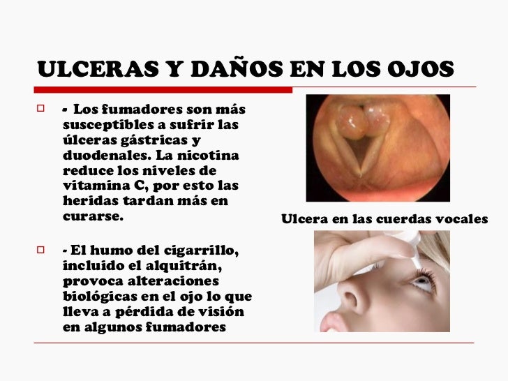 El tratamiento del alcoholismo g volgograd