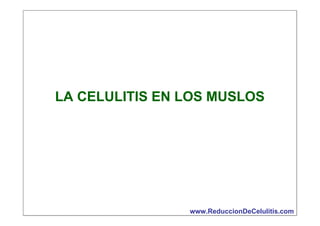 LA CELULITIS EN LOS MUSLOS

www.ReduccionDeCelulitis.com

 