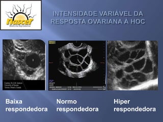 Baixa          Normo          Hiper
respondedora   respondedora   respondedora
 