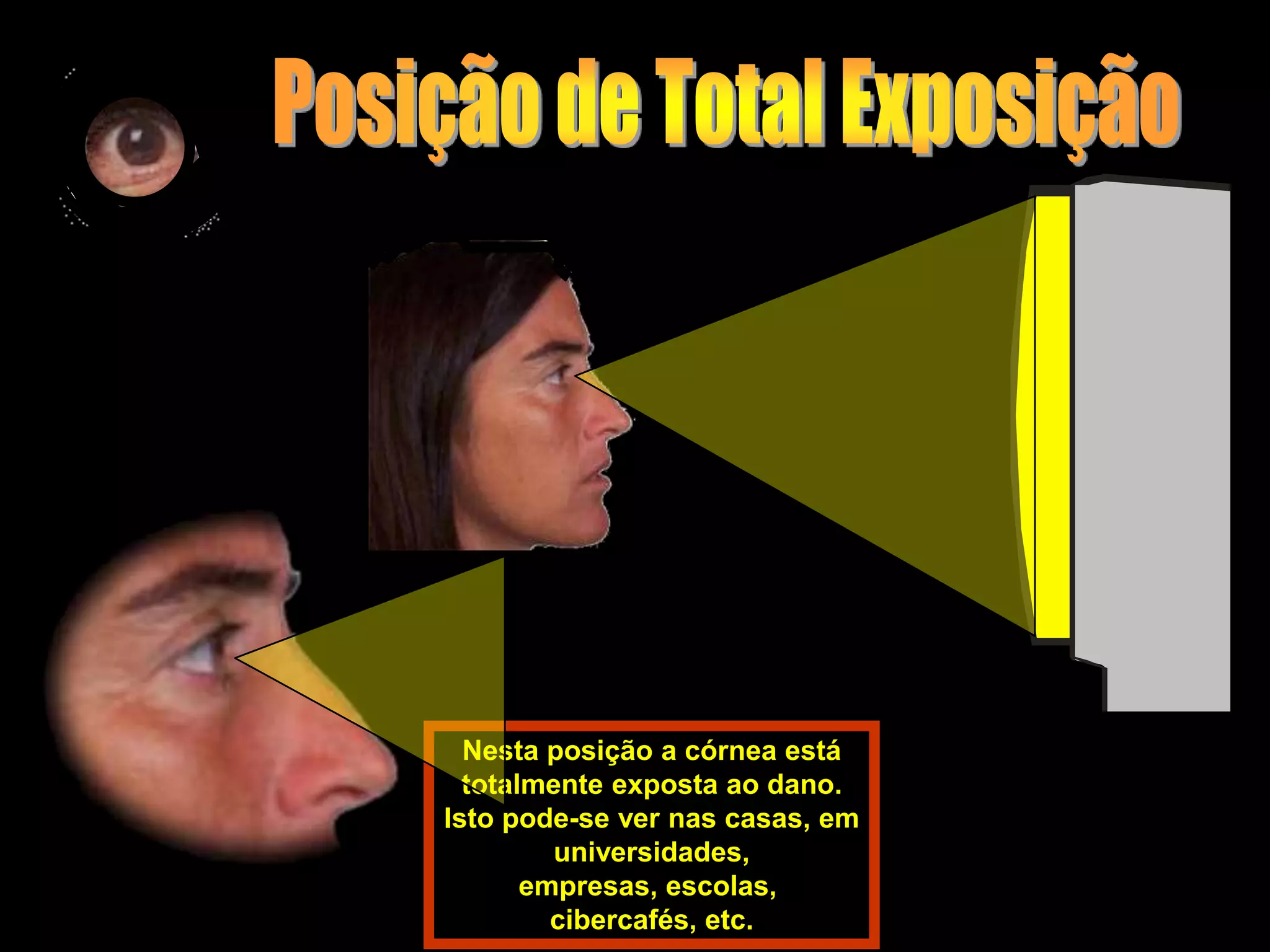 Nesta posição a córnea está
  totalmente exposta ao dano.
Isto pode-se ver nas casas, em
         universidades,
       empresas, escolas,
         cibercafés, etc.
 