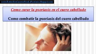 www.RemediosCaserosParaLaPsoriasis.blogspot.com

Como curar la psoriasis en el cuero cabelludo
Como combatir la psoriasis del cuero cabelludo

 