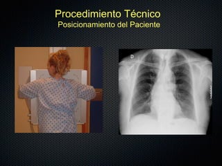 Procedimiento Técnico
Posicionamiento del Paciente
 