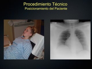 Procedimiento Técnico
Posicionamiento del Paciente
 