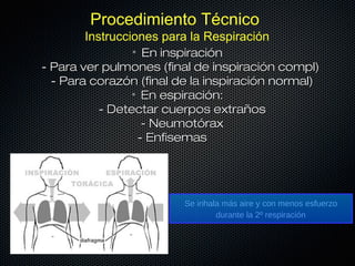 Procedimiento Técnico
       Instrucciones para la Respiración
                • En inspiración
- Para ver pulmones (final de inspiración compl)
  - Para corazón (final de la inspiración normal)
               • En espiración:
          - Detectar cuerpos extraños
                  - Neumotórax
                 - Enfisemas




                         Se inhala más aire y con menos esfuerzo
                                 durante la 2º respiración
 
