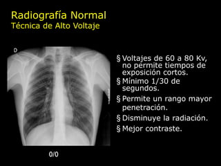 Radiografía Normal
Técnica de Alto Voltaje



                          § Voltajes de 60 a 80 Kv,
                            no permite tiempos de
                            exposición cortos.
                          § Mínimo 1/30 de
                            segundos.
                          § Permite un rango mayor
                            penetración.
                          § Disminuye la radiación.
                          § Mejor contraste.


         0/0
 