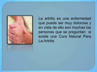 La artritis es una enfermedad
que puede ser muy dolorosa y
en vista de ello son muchas las
personas que se preguntan si
existe una Cura Natural Para
La Artritis
 
