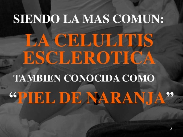 Consumes pastillas para bajar de peso naturales sin rebote conoce caso una pastillas para bajar de peso naturales sin rebote