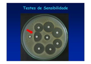 Testes de Sensibilidade
Testes de Sensibilidade
 