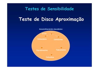 Testes de Sensibilidade
Testes de Sensibilidade
Ceftazidima Cefotaxima
Amoxicilina/ácido clavulânico
Ciprofloxacina Tobramicina
Cefoxitina
20 mm
Teste de Disco Aproximação
 